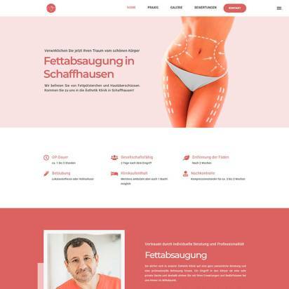 liposuction-schaffhausen.ch